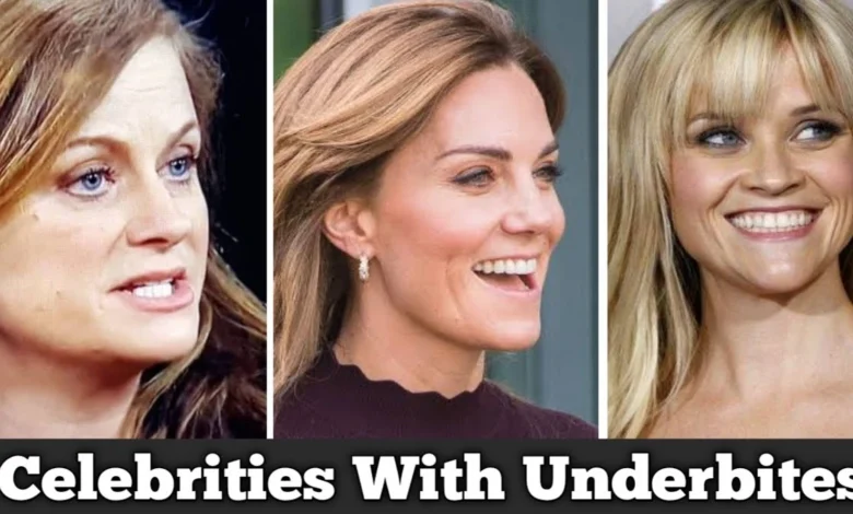 Actors with Underbite